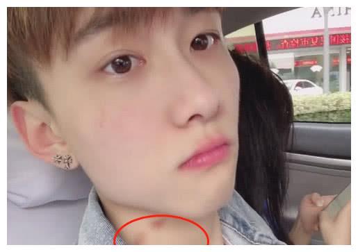 王乐乐“回归”快手？大方露脸很嚣张，脖子被套路璐赐“一抹红”